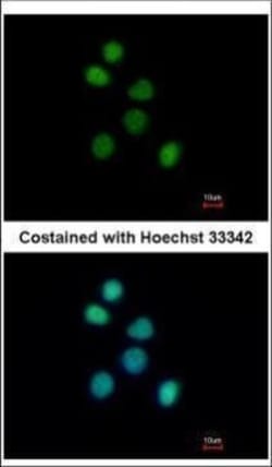 Invitrogen FES Polyclonal Antibody 100 &mu;L; Unconjugated:Antibodies,