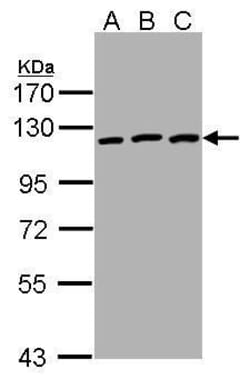 Invitrogen EphB3 Polyclonal Antibody 100 &mu;L; Unconjugated:Antibodies,