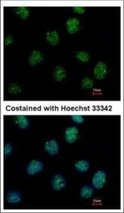 Invitrogen IP6K2 Polyclonal Antibody 100 &mu;L; Unconjugated:Antibodies,