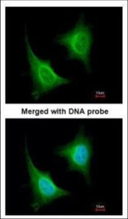 Invitrogen TAB1 Polyclonal Antibody 100 &mu;L; Unconjugated:Antibodies,