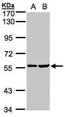 Invitrogen TAB1 Polyclonal Antibody 100 &mu;L; Unconjugated:Antibodies,