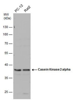Invitrogen CK2 alpha-1 Polyclonal Antibody 100 &mu;L; Unconjugated:Antibodies,