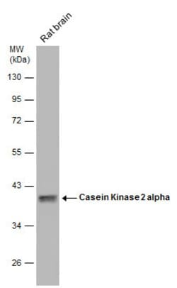 Invitrogen CK2 alpha-1 Polyclonal Antibody 100 &mu;L; Unconjugated:Antibodies,