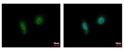 Invitrogen CK2 alpha-1 Polyclonal Antibody 100 &mu;L; Unconjugated:Antibodies,