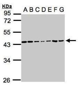Invitrogen CK2 alpha-1 Polyclonal Antibody 100 &mu;L; Unconjugated:Antibodies,