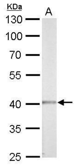 Invitrogen CK2 alpha-1 Polyclonal Antibody 100 &mu;L; Unconjugated:Antibodies,