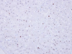 Invitrogen VRK1 Polyclonal Antibody 100 &mu;L; Unconjugated:Antibodies,