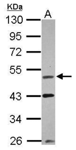 Invitrogen VRK1 Polyclonal Antibody 100 &mu;L; Unconjugated:Antibodies,