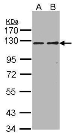 Invitrogen RIPK5 Polyclonal Antibody 100 &mu;L | Buy Online | Invitrogen&trade; | Fisher Scientific