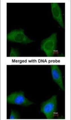 Invitrogen CoA Synthase Polyclonal Antibody 100 &mu;L; Unconjugated:Antibodies,