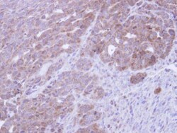 Invitrogen CoA Synthase Polyclonal Antibody 100 &mu;L; Unconjugated:Antibodies,