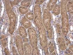 Invitrogen CoA Synthase Polyclonal Antibody 100 &mu;L; Unconjugated:Antibodies,