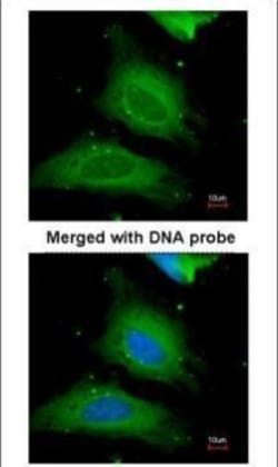 Invitrogen UGP2 Polyclonal Antibody 100 &mu;L; Unconjugated:Antibodies,
