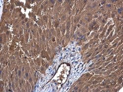 Invitrogen UGP2 Polyclonal Antibody 100 &mu;L; Unconjugated:Antibodies,