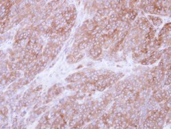 Invitrogen UGP2 Polyclonal Antibody 100 &mu;L; Unconjugated:Antibodies,