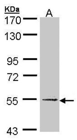 Invitrogen UGP2 Polyclonal Antibody 100 &mu;L; Unconjugated:Antibodies,