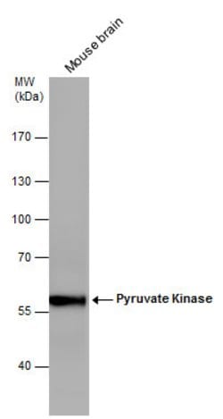 Invitrogen PKM2 Polyclonal Antibody 100 &mu;L | Buy Online | Invitrogen&trade; | Fisher Scientific