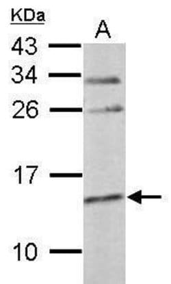 Invitrogen Cystatin C Polyclonal Antibody 100 &mu;L | Buy Online | Invitrogen&trade; | Fisher Scientific