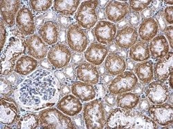 Invitrogen PUM2 Polyclonal Antibody 100 &mu;L; Unconjugated:Antibodies,