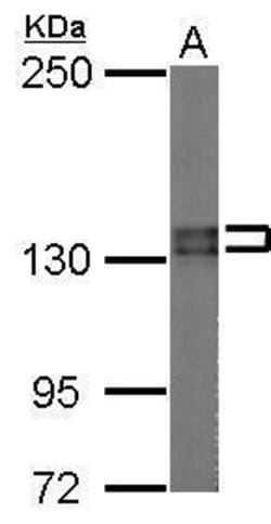 Invitrogen PUM2 Polyclonal Antibody 100 &mu;L; Unconjugated:Antibodies,