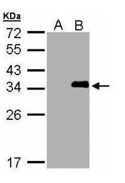 Invitrogen LASP1 Polyclonal Antibody 100 &mu;L; Unconjugated:Antibodies,
