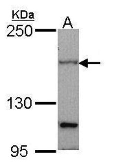Invitrogen PTCH Polyclonal Antibody 100 &mu;L; Unconjugated:Antibodies,