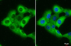 Invitrogen RBP1 Polyclonal Antibody 100 &mu;L; Unconjugated:Antibodies,