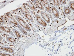 Invitrogen RBP1 Polyclonal Antibody 100 &mu;L; Unconjugated:Antibodies,