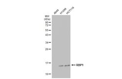 Invitrogen RBP1 Polyclonal Antibody 100 &mu;L; Unconjugated:Antibodies,