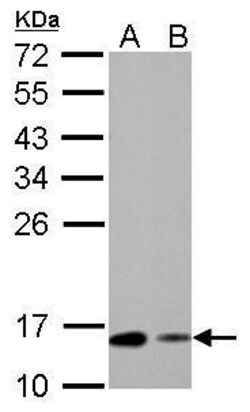 Invitrogen RBP1 Polyclonal Antibody 100 &mu;L; Unconjugated:Antibodies,