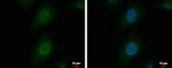 Invitrogen SNUPN Polyclonal Antibody 100 &mu;L; Unconjugated:Antibodies,