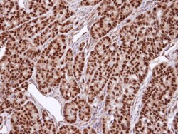 Invitrogen SNUPN Polyclonal Antibody 100 &mu;L; Unconjugated:Antibodies,