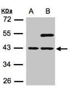 Invitrogen SNUPN Polyclonal Antibody 100 &mu;L; Unconjugated:Antibodies,