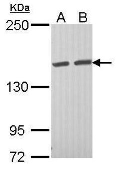 Invitrogen TAB182 Polyclonal Antibody 100 &mu;L | Buy Online | Invitrogen&trade; | Fisher Scientific