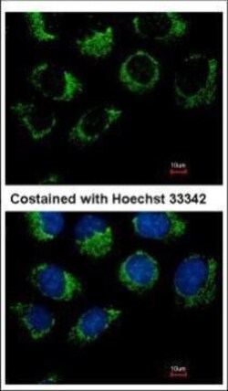 Invitrogen GPR32 Polyclonal Antibody 100 μL; Unconjugated:Antibodies,