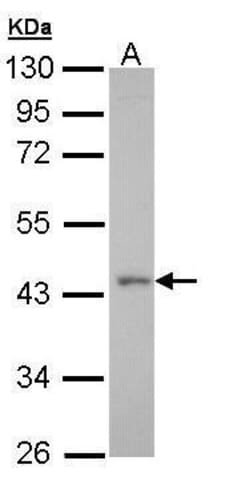 Invitrogen GPR32 Polyclonal Antibody 100 μL; Unconjugated:Antibodies,