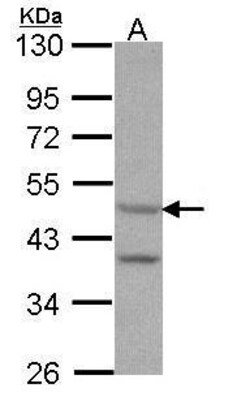 HTR7 Polyclonal Antibody, Invitrogen 100 &mu;L | Buy Online | Thermo Scientific | Fisher Scientific