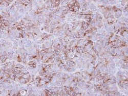Invitrogen GALR3 Polyclonal Antibody 100 &mu;L; Unconjugated:Antibodies,