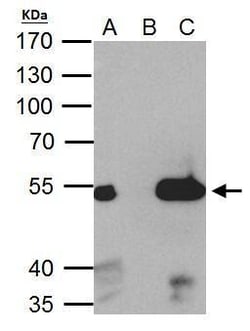 Invitrogen ESRRA Polyclonal Antibody 100 &mu;L; Unconjugated:Antibodies,