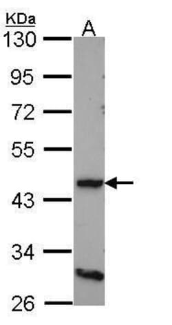 D4 Dopamine Receptor Polyclonal Antibody, Invitrogen 100 &mu;L; Unconjugated:Antibodies,