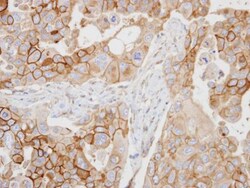 CD97 Polyclonal Antibody, Invitrogen 100 μL; Unconjugated:Antibodies,