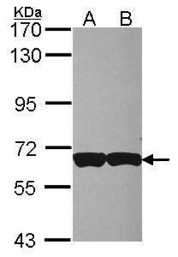 CD97 Polyclonal Antibody, Invitrogen 100 μL; Unconjugated:Antibodies,