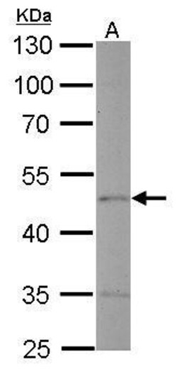 Endothelin B Receptor Polyclonal Antibody, Invitrogen 100 &mu;L; Unconjugated:Antikroppar