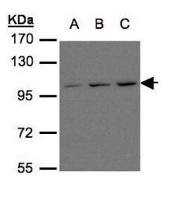 mGluR6 Polyclonal Antibody, Invitrogen 100 &mu;L; Unconjugated:Antibodies,