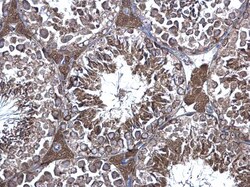 Invitrogen eRF1 Polyclonal Antibody 100 μL; Unconjugated:Antibodies,