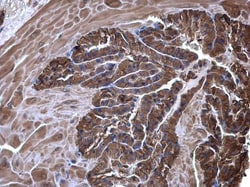 Invitrogen eRF1 Polyclonal Antibody 100 μL; Unconjugated:Antibodies,