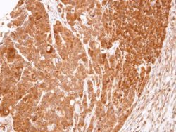 Invitrogen eRF1 Polyclonal Antibody 100 μL; Unconjugated:Antibodies,