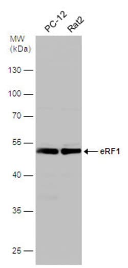 Invitrogen eRF1 Polyclonal Antibody 100 μL; Unconjugated:Antibodies,