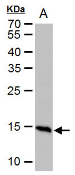 Invitrogen Histone H2A.X Polyclonal Antibody 100 μL; Unconjugated:Antibodies,