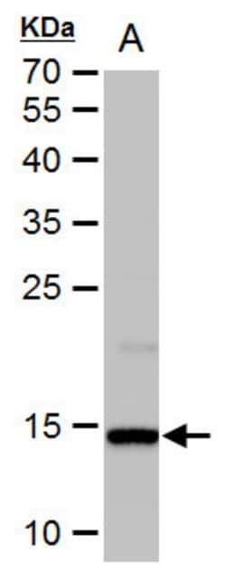 Invitrogen Histone H2A.X Polyclonal Antibody 100 μL; Unconjugated:Antibodies,